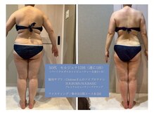 千歳の女神 刈谷店/Before/After