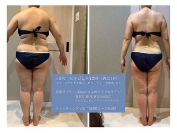 千歳の女神 刈谷店/Before/After