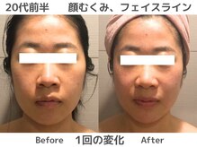 マテリアル(MATERIAL)/一度でフェイスラインに変化！