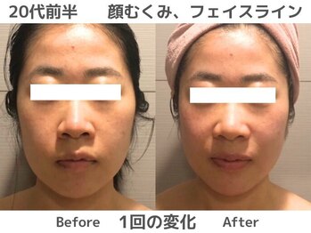 マテリアル(MATERIAL)/一度でフェイスラインに変化！