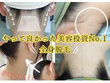 ユーサロン(U-Salon)