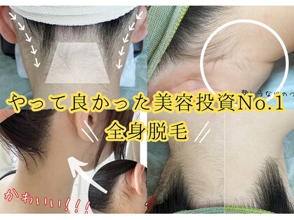 ユーサロン(U-Salon)の写真