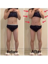 スペチアーレ 夙川/小顔と美ボディGET