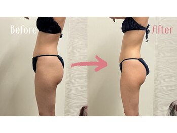 エスビーエス オキナワ(SBS OKINAWA)/痩身モニター様