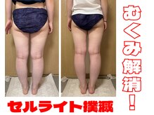 ブルーム(BL∞M)の雰囲気（凸凹セル脂肪＆リンパの詰まりを一気に撃退！）