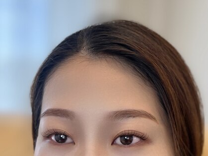 ペレ(PELE)の写真