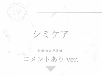ラヴィオーラ 烏丸(LV)/ダイヤモンドハーブピーリング