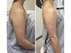 ルマエクレ(rmaecla)の写真/横から5kg痩せ見え。二の腕は"肩から"細くする。