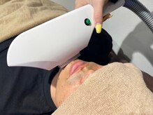 ビジュー(bjyou)/全顔脱毛