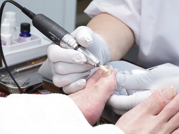 巻爪レスキュー 尼崎/