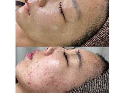 ベリッシマ(Bellissima)の写真