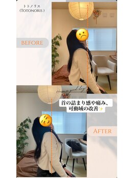 トトノリス(Totonoris)/ビフォーアフター3