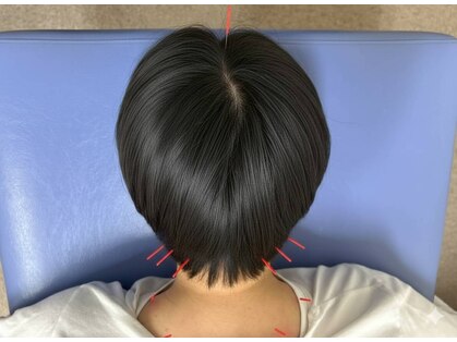 ゆうゆう整体 宇都宮鍼灸院の写真