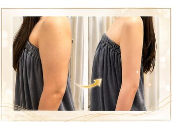 ラピスラズリの写真/痩せにくい箇所も徹底！【リンパマッサージ×高周波】で背中・肩甲骨・二の腕＆首肩コリもお任せ◎