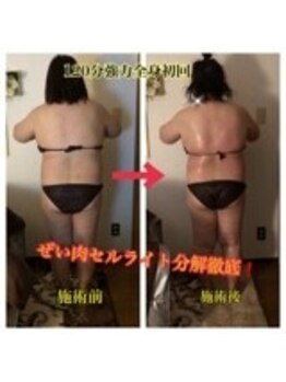 強め筋膜痩身リンパ 小顔エステBAR北野/