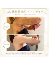 マドモアゼルアネックス 麻布十番