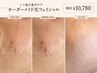 【シミ悩み集中ケア】オーダーメイド光フェイシャル¥24,200→¥10,780