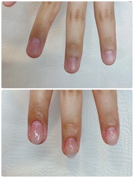 ココ ネイル サロン アンドスクール(COCO.NAIL SALON＆SCHOOL)/爪噛みケア