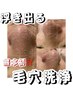 韓国式3D毛穴洗浄　　14,000円