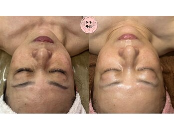 トレテル/泡ほぐしプレミアムフェイシャル