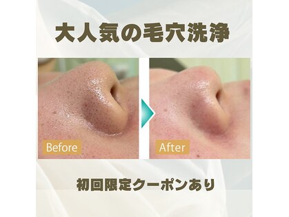ホワイトニングジム アイスの写真