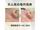 ホワイトニングジム アイスの写真