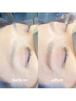 アイクイック 日暮里 西日暮里駅前店(Ai Quick)/アイブロウワックス脱毛