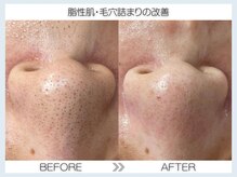 フェアリー(fairy)/