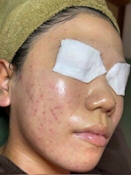 ハリツヤをUPしたい