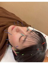 リフレ鍼灸整骨院/美容鍼