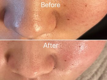 アリス(Alice)/マツヤニWAX Before/After