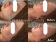 アピュルテ(A purete')の写真