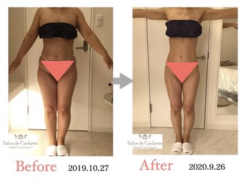 サロン ド カシェット 銀座/お客様のビフォーアフター例