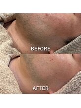 ミジョカフェイシャル(mijoka facial)/