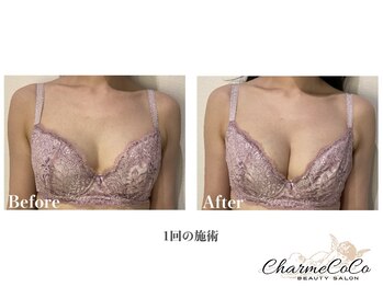 シャルムココ 蔵前店(CharmeCoCo)/お客様Before→After