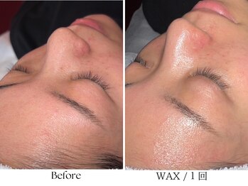 ビボーラ(BEBEAURA)/☆肌育WAX☆