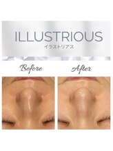 トータルビューティーサロン ルース(LUZ)/イラストリアス