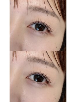 リノ(Lino)/コスメリフト