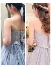 サンテボーテ(Sante Beaute)/痩身ブライダルエステ