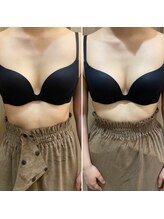 エステティック レイビス 池袋店(RAYVIS)/バストケア