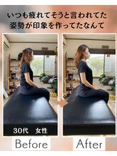 ウェルビーイング整体院 水戸赤塚店(wellbeing整体院)/Before After