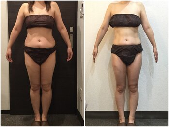 美容整体ウェリナ あま甚目寺院/小顔矯正/骨盤矯正/美脚サロン