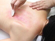 太陽の癒やし 国分寺店/身体顔むくみケア全身かっさ60分