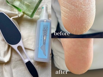 シエルクネイル(CieLc nail)の写真/【鹿嶋市唯一】美容液で磨くからモチが違う！！触れた瞬間わかる、ふわふわ角質ケア♪