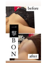 ルールー(Lulu)/バストアップ