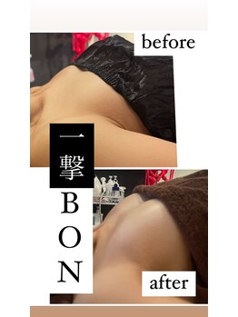 ルールー(Lulu)/バストアップ