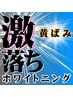 激落ちホワイトニング20×3回照射★※既にカウンセリング受けた方専用