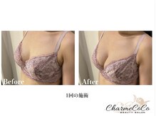 シャルムココ 蔵前店(CharmeCoCo)/お客様Before→After