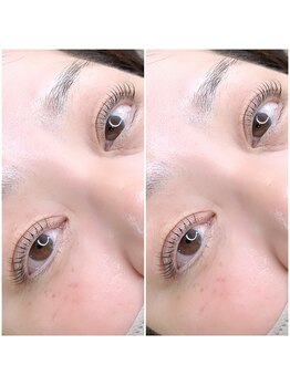 プリムス(Primus)/ラッシュリフト