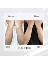 ティグレ 岡山店(TIGRE)/メンズ全身（顔VIO込）